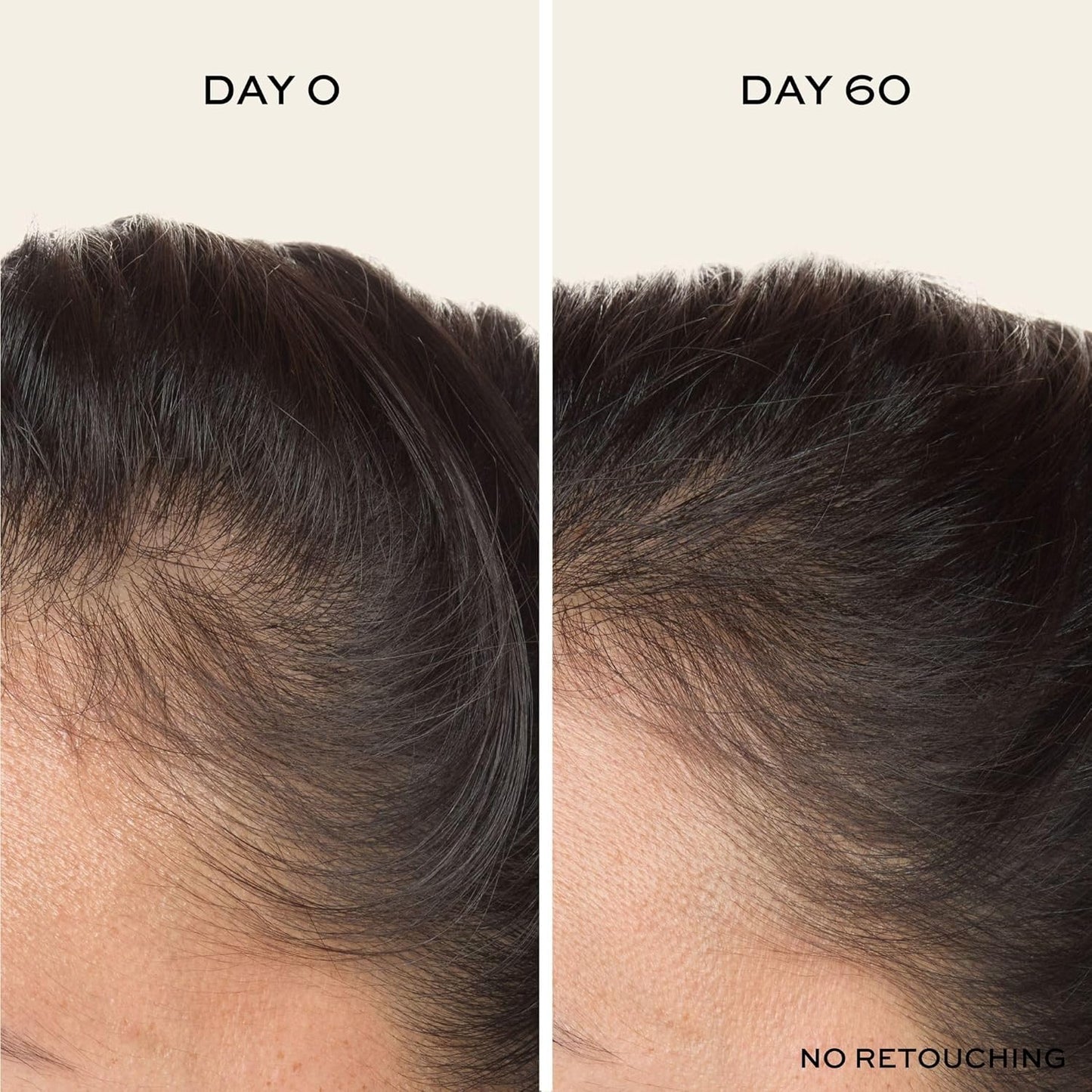 John Frieda ULTRAFiller+ Scalp Serum – Økt Hårtetthet & Fyldigere Hår (Biotin + Peptider)